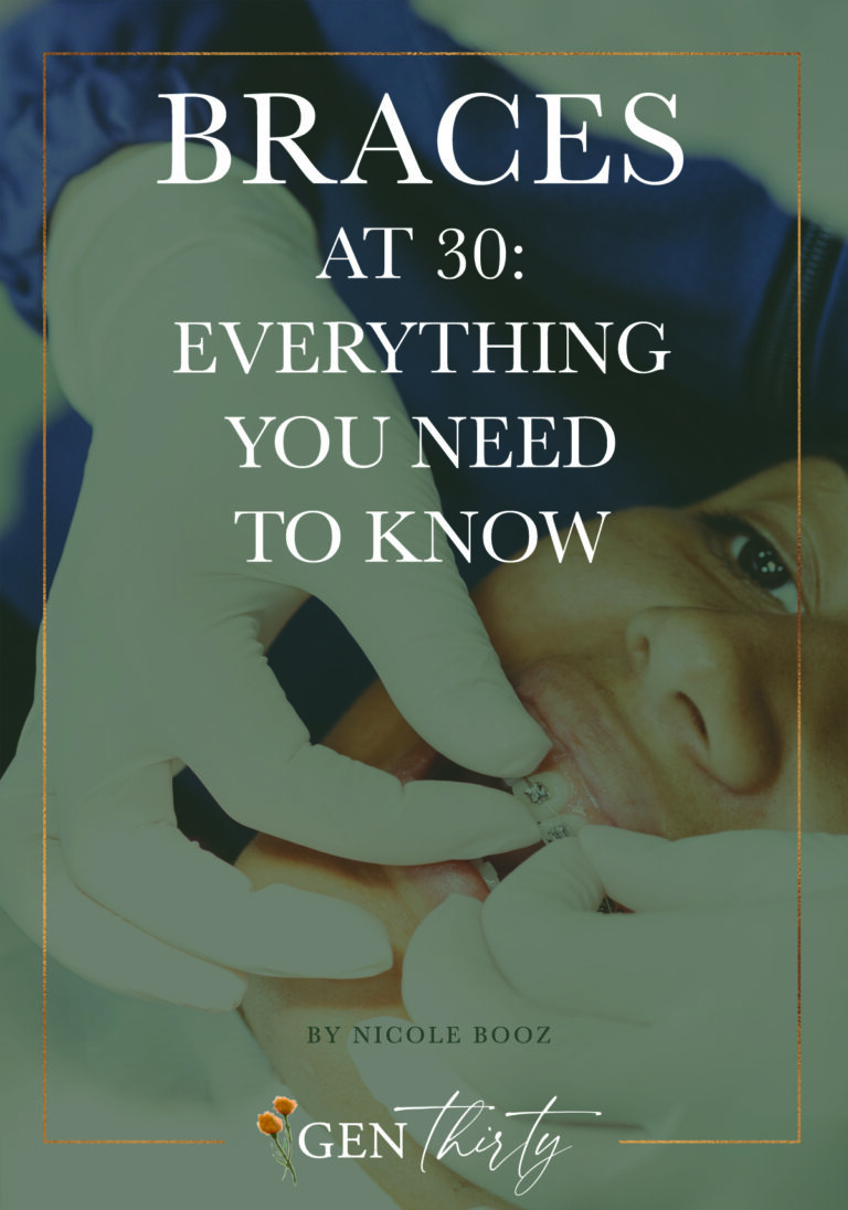 What You Really Need To Know About Having Braces In Your 30s