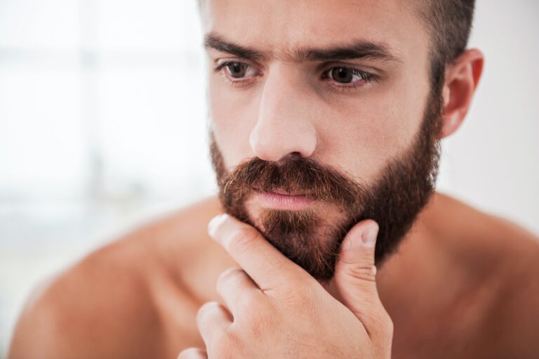 grey beard at 30